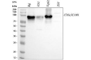 Western blot analysis of ICAM1 using anti-ICAM1 antibody (ABIN5692991). (ICAM1 抗体  (AA 28-268))