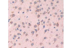 Used in DAB staining on fromalin fixed paraffin- embedded brain tissue (SYN2 抗体  (AA 88-422))
