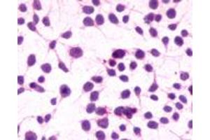 Anti-CNR1 / CB1 antibody immunocytochemistry (ICC) staining of untransfected HEK293 human embryonic kidney cells. (CNR1 抗体  (C-Term))