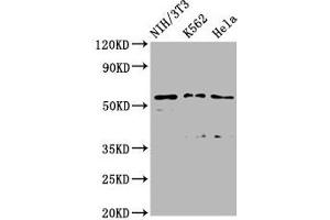 Western Blot Positive WB detected in: NIH/3T3 whole cell lysate, K562 whole cell lysate, Hela whole cell lysate All lanes: TTC26 antibody at 2. (TTC26 抗体  (AA 5-122))