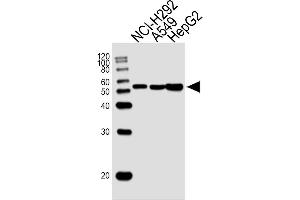 Lane 1: NCI-H292 Cell lysates, Lane 2: A549 Cell lysates, Lane 3: HepG2 Cell lysates, probed with ALDH2 (138CT22. (ALDH2 抗体)