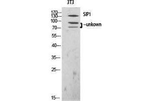 Western Blotting (WB) image for anti-Gem (Nuclear Organelle) Associated Protein 2 (GEMIN2) (N-Term) antibody (ABIN3177416) (SIP1 抗体  (N-Term))