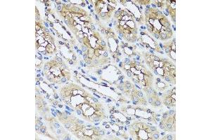 Immunohistochemistry of paraffin-embedded mouse kidney using AIP antibody. (AIP 抗体  (AA 1-330))