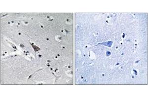 Immunohistochemistry analysis of paraffin-embedded human brain, using SLC6A16 Antibody. (SLC6A16 抗体  (AA 233-282))