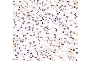 Immunohistochemistry (Paraffin-embedded Sections) (IHC (p)) image for anti-General Transcription Factor IIIC, Polypeptide 3, 102kDa (GTF3C3) antibody (ABIN7074039)