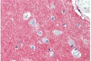 Human Brain, Cortex: Formalin-Fixed, Paraffin-Embedded (FFPE) (GNAI3 抗体  (AA 181-230))