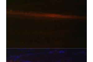 Immunofluorescence analysis of Rat retina using RDH5 Polyclonal Antibody at dilution of 1:100 (40x lens). (RDH5 抗体)