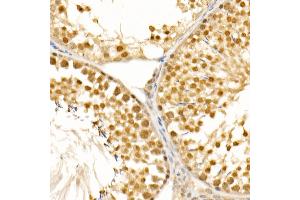 Immunohistochemistry (IHC) image for anti-Cyclin-Dependent Kinase 1 (CDK1) antibody (ABIN7266576)