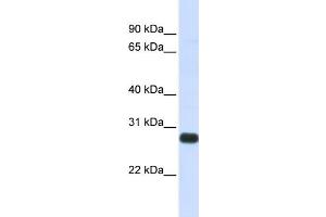 WB Suggested Anti-SPINT2 Antibody Titration:  0. (SPINT2 抗体  (Middle Region))
