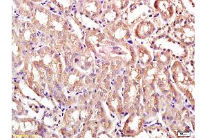 Formalin-fixed and paraffin embedded rat kidney labeled with Anti-Ceramide synthase 2 Polyclonal Antibody, Unconjugated (ABIN709331) at 1:200 followed by conjugation to the secondary antibody and DAB staining (Ceramide Synthase 2 抗体  (AA 201-300))