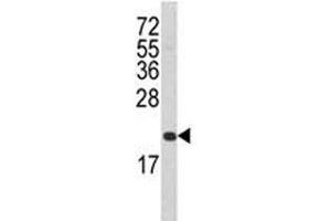 Western blot analysis of FAS antibody and T47D lysate. (FAS 抗体  (AA 185-211))