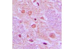 Immunohistochemical analysis of SYT staining in human brain formalin fixed paraffin embedded tissue section. (SS18 抗体  (N-Term))