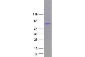 Western Blotting (WB) image for Casein Kinase 1, gamma 3 (CSNK1G3) (Transcript Variant 4) protein (Myc-DYKDDDDK Tag) (ABIN2712581)