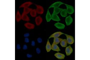 ABIN6265156 and ABIN6278272 staining Hela cells(30 min of UV treatment) by IF/ICC.
