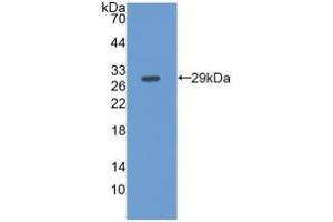 Detection of Recombinant FBLN3, Human using Monoclonal Antibody to Fibulin 3 (FBLN3) (FBLN3 抗体  (AA 258-493))