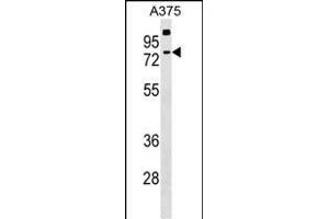TKTL2 Antibody (N-term) (ABIN1539379 and ABIN2848983) western blot analysis in  cell line lysates (35 μg/lane). (TKTL2 抗体  (N-Term))