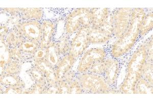 Detection of LEPR in Human Kidney Tissue using Polyclonal Antibody to Leptin Receptor (LEPR)