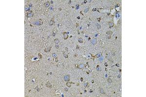 Immunohistochemistry of paraffin-embedded mouse brain using FDX1 antibody. (Ferredoxin1 (FDX1) 抗体)