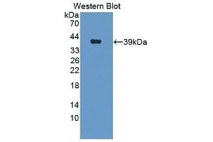 Western Blotting (WB) image for anti-Insulin Receptor (INSR) (AA 1027-1364) antibody (ABIN1859482) (Insulin Receptor 抗体  (AA 1027-1364))