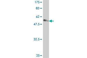 Western Blot detection against Immunogen (56. (HAX1 抗体  (AA 1-279))
