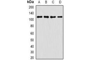 Western blot analysis of ANR52 expression in A549 (A), K562 (B), mouse brain (C), rat liver (D) whole cell lysates. (ANKRD52 抗体)