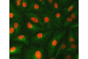 IF analysis of U1-C/SNRPC and Tubulin beta using anti-U1-C/SNRPC antibody (ABIN7599016) and anti-Tubulin beta antibody (ABIN7602744).