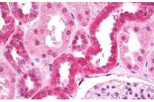 Anti-FIH / CASR antibody IHC staining of human kidney, tubules. (CASR 抗体  (AA 214-235))