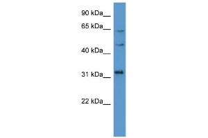 WB Suggested Anti-MKNK1 Antibody Titration: 0. (MKNK1 抗体  (C-Term))