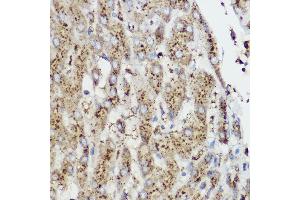 Immunohistochemistry of paraffin-embedded Rat cartilage using Aggrecan Rabbit pAb (ABIN6127417, ABIN6136406, ABIN6136408 and ABIN6224631) at dilution of 1:50 (40x lens). (Aggrecan 抗体  (AA 20-280))
