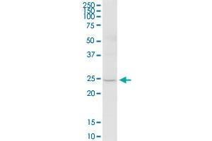 TMED5 MaxPab polyclonal antibody. (TMED5 抗体  (AA 1-229))