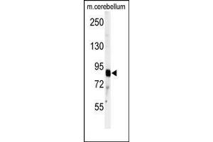 Western Blotting (WB) image for anti-ADAM Metallopeptidase with Thrombospondin Type 1 Motif, 4 (ADAMTS4) (C-Term) antibody (ABIN359602)