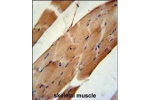 CNO6L Antibody (C-term) (ABIN651400 and ABIN2840217) immunohistochemistry analysis in formalin fixed and paraffin embedded human skeletal muscle followed by peroxidase conjugation of the secondary antibody and DAB staining. (CNOT6L 抗体  (C-Term))