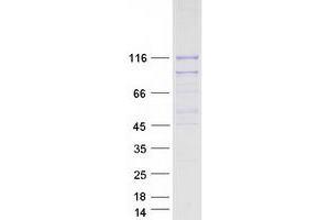 Western Blotting (WB) image for Salt-Inducible Kinase 2 (SIK2) protein (Myc-DYKDDDDK Tag) (ABIN2732053)