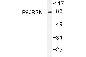 Image no. 1 for anti-Ribosomal Protein S6 Kinase, 90kDa, Polypeptide 1 (RPS6KA1) antibody (ABIN271934) (RPS6KA1 抗体)