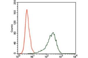 Immunohistochemical analysis of paraffin-embedded ovarian cancer tissues using SRY antibody with DAB staining. (SRY 抗体  (AA 1-204))
