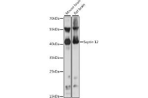 Western blot analysis of extracts of various cell lines, using Septin 12 antibody (ABIN7265307) at 1:1000 dilution. (Septin 12 抗体  (AA 189-358))