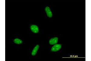 Immunofluorescence of purified MaxPab antibody to ERCC8 on HeLa cell. (ERCC8 抗体  (AA 1-396))