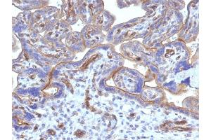 Immunohistochemistry (IHC) image for anti-Thrombomodulin (THBD) (AA 69-194) antibody (ABIN6940728)