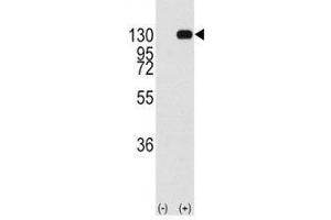 Western Blotting (WB) image for anti-Fibroblast Growth Factor Receptor 1 (FGFR1) (AA 441-470) antibody (ABIN3029718)