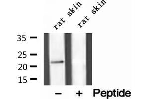 Western blot analysis of extracts of rat skin tissue, using Dermatopontin antibody. (Dermatopontin 抗体  (Internal Region))