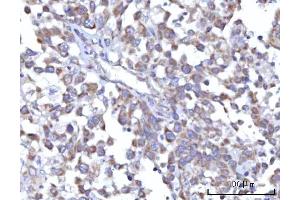 IHC analysis of C18orf22/RBFA using anti-C18orf22/RBFA antibody (ABIN7600106).