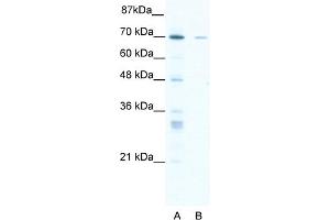 WB Suggested Anti-ZNF37A Antibody Titration:  1. (ZNF37A 抗体  (Middle Region))