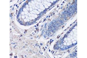 Immunohistochemistry of paraffin-embedded Human colon using NLRC4 Polyclonal Antibody at dilution of 1:100 (40x lens). (NLRC4 抗体)