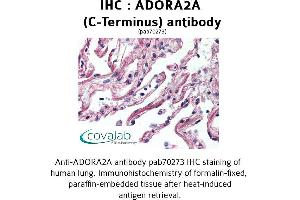 Image no. 2 for anti-Adenosine A2a Receptor (ADORA2A) (C-Term), (Cytoplasmic Domain) antibody (ABIN1731565)