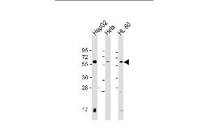 All lanes : Anti-PI4K2A Antibody (C-term) at 1:2000 dilution Lane 1: HepG2 whole cell lysate Lane 2: Hela whole cell lysate Lane 3: HL-60 whole cell lysate Lysates/proteins at 20 μg per lane. (PI4K2A 抗体  (C-Term))