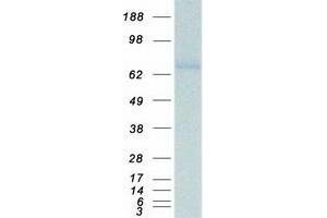 Western Blotting (WB) image for Matrix Metallopeptidase 14 (Membrane-inserted) (MMP14) protein (Myc-DYKDDDDK Tag) (ABIN2726152)