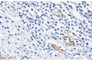Immunohistochemistry (Paraffin-embedded Sections) (IHC (p)) image for anti-Mucosal Vascular Addressin Cell Adhesion Molecule 1 (MADCAM1) antibody (ABIN7010289)
