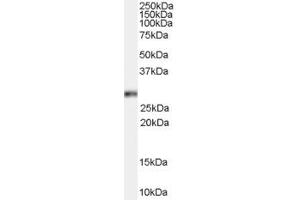 Western Blotting (WB) image for anti-Homeobox B13 (HOXB13) (C-Term) antibody (ABIN2465823) (HOXB13 抗体  (C-Term))