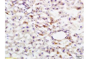 Formalin-fixed and paraffin embedded rat liver tissue labeled with Anti-phospho-HMGCR(Ser872) Polyclonal Antibody, Unconjugated (ABIN753283) at 1:200 followed by conjugation to the secondary antibody and DAB staining (HMGCR 抗体  (pSer872))
