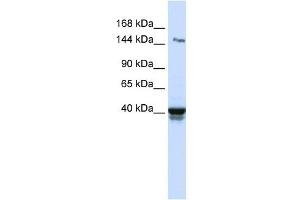 IGSF9 antibody used at 1 ug/ml to detect target protein. (IGSF9 抗体  (N-Term))